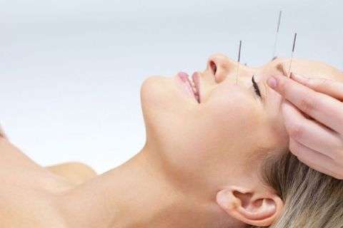 Kozmetik Akupunktur